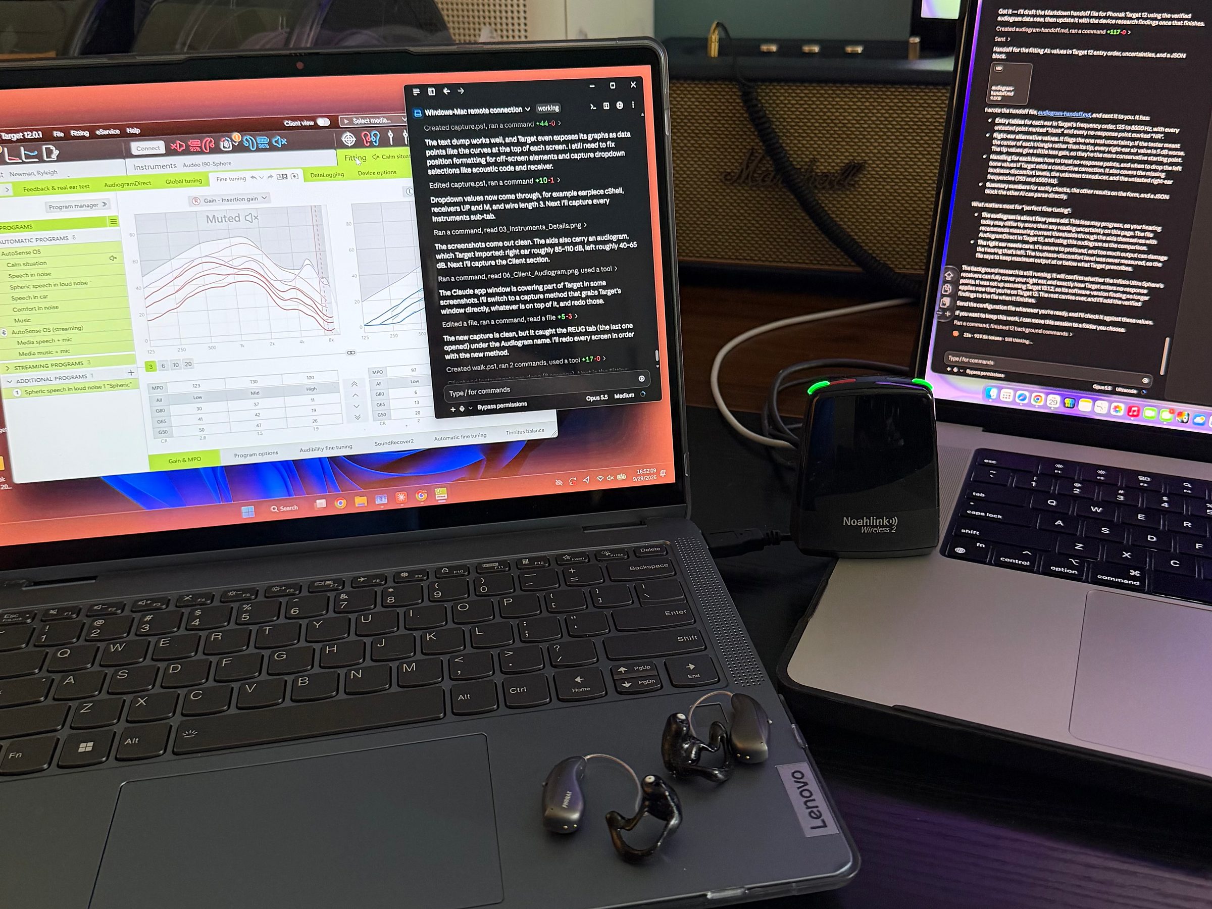 A Lenovo Windows laptop running Phonak Target 12.0.1 with a Claude window on top, a MacBook beside it running the supervising Claude session, a Noahlink Wireless 2 programming dongle between them, and two Phonak Audeo Sphere hearing aids with black custom shells on the Lenovo palm rest.