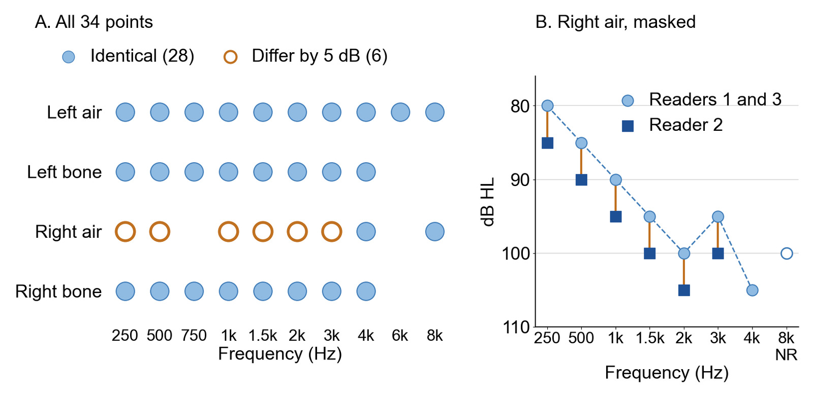 Two panels. A: all 34 plotted points by series and frequency, 28 identical in all three readings and 6 that differ by 5 dB, all in the right air row at 250, 500, 1000, 1500, 2000 and 3000 Hz. B: the right ear masked air values, where reader 2 read every disputed triangle exactly 5 dB worse than readers 1 and 3.