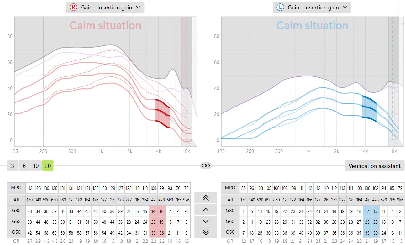 Phonak Target fine tuning screen for the Calm situation program, with right ear gain curves in red, left ear curves in blue, and the 20-channel gain and maximum output grids below.